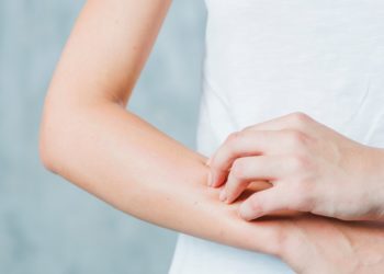 Η άνοιξη ήρθε: Όλα όσα πρέπει να γνωρίζουμε για την αλλεργία & την αναφυλαξία